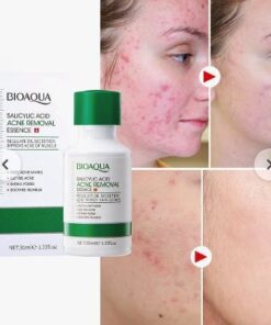 سرم صورت ضد جوش و آکنه سالیسیلیک اسید حجم 35 میل